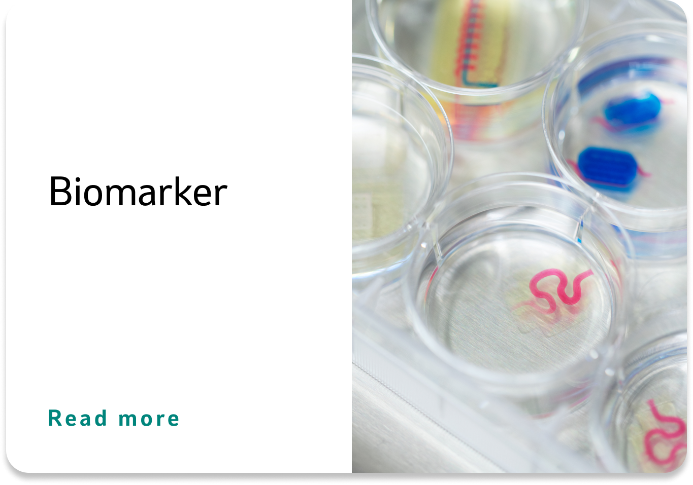 Diabetes biomarker